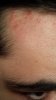 derma22.jpg