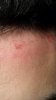 derma1.jpg