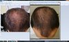 comparison 3 week-8week.jpg