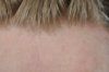 hairline front (hr).jpg