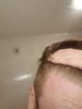 hairline left temple 2.jpg hairline left temple 2.jpg