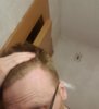Hairline right temple (2).jpg Hairline right temple (2).jpg