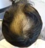 Hair 3.png