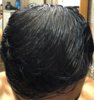 13 months after transplant, damp hair in less light.jpg