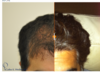 Doctor told me my results will be similar to this patient.png