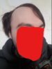 Forehead 2.PNG