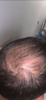 growth.PNG