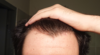 hairline_front.png hairline_front.png