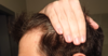 hairline_left.png hairline_left.png