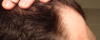 hairline_right.png hairline_right.png