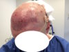 Day 1.3 - Post.JPG Day 1.3 - Post.JPG