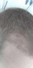 befshedding 2.jpg