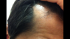 B99E8444-4863-4798-B32A-1CF2D8A6C584.png