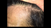 71F0D7BE-E4B0-4039-83C9-7C306E422097.png