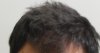 wider hairline and thick.jpg wider hairline and thick.jpg