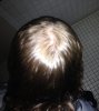crown dark 1.jpg