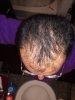 11 feb, after 4 months of lipogaine and 6 rolling.jpg 11 feb, after 4 months of lipogaine and 6 rolling.jpg