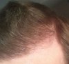 shareforum_hairline.jpg