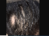 beforen.PNG