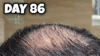 Crown 86.png