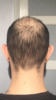 BD28D150-73B7-4FB3-9717-24EBD83D2209.png