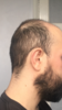 50E13D6A-D7DC-4B72-8DC5-DEE50CA2CF77.png