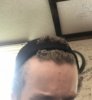 hairline3.jpg
