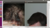 Dr Woods before and after.png
