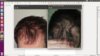 Dr Chan Before After Top.jpeg