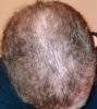 After 6 months  (3).jpg
