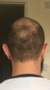BB9A4A82-E942-4E3E-A36E-AE027C41FC88.png