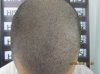 1month-after.jpg
