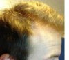 bald 1.jpg