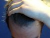 bald 4.jpg