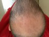 hair.jpg hair.jpg
