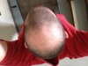 hairfour.jpg hairfour.jpg