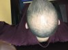 hairthree.jpg hairthree.jpg