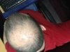 Hairtwo.jpg Hairtwo.jpg