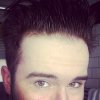 hair loss or high hairline.jpg