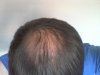 Current hair.jpg