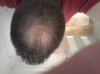 Current hair 2.jpg