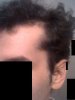 peleta izq.jpg peleta izq.jpg