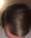 2019april_lefttemple_dry.png