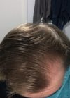 2020now_righttemple_wet.png