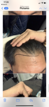 922948E1-2EBF-47BB-B258-52421B38C2F3.png