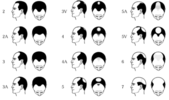 norwood_scale.gif