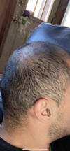 726321BA-ADF2-4ADF-8441-54CA7050FDC1.png