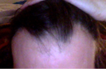 hairl.png