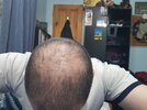 20201218_213648.jpg