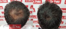 tratamiento-capilar-dr-pelo_16.jpg